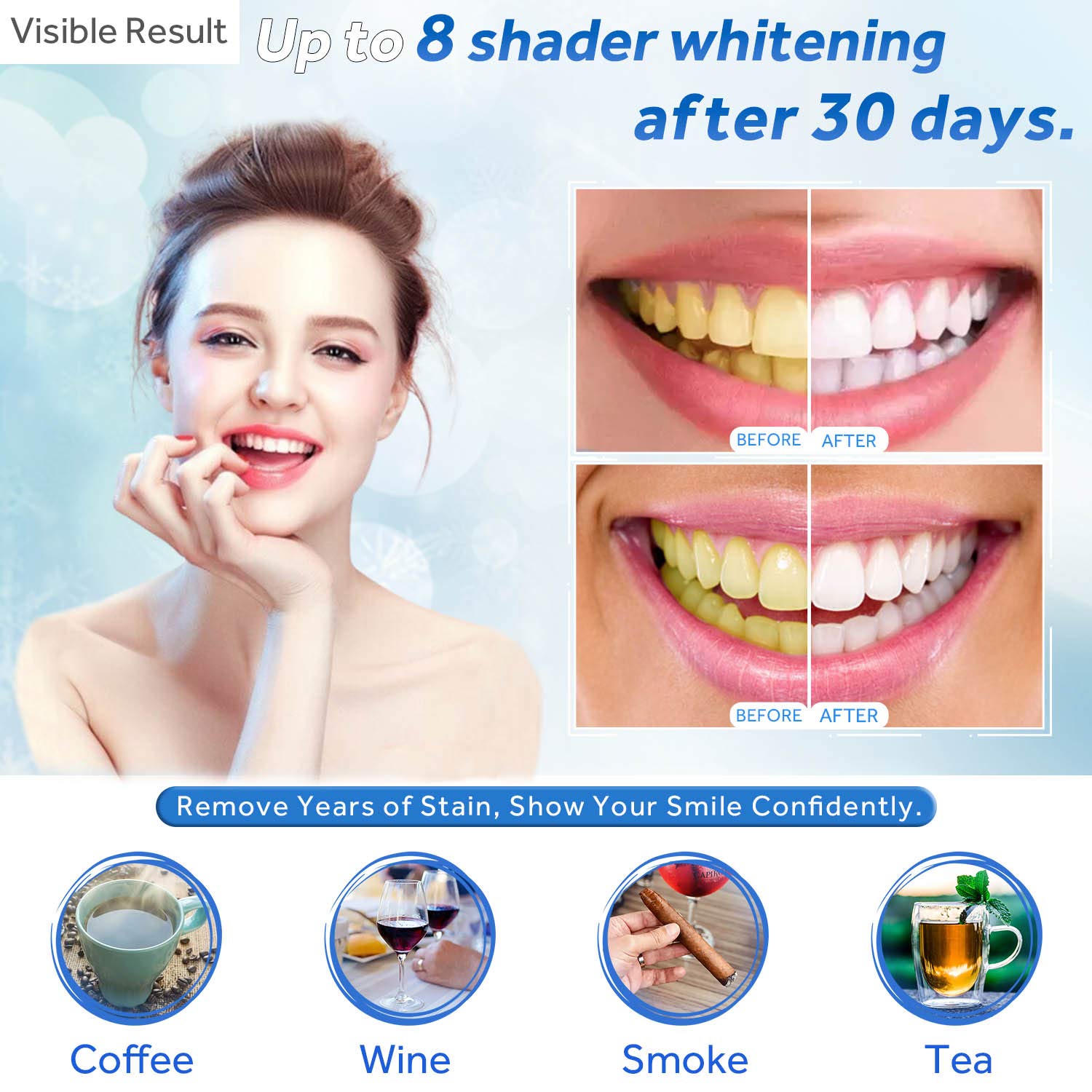 Teeth Whitening Gel Refill Syr - Teeth Whitening Near Me review and price