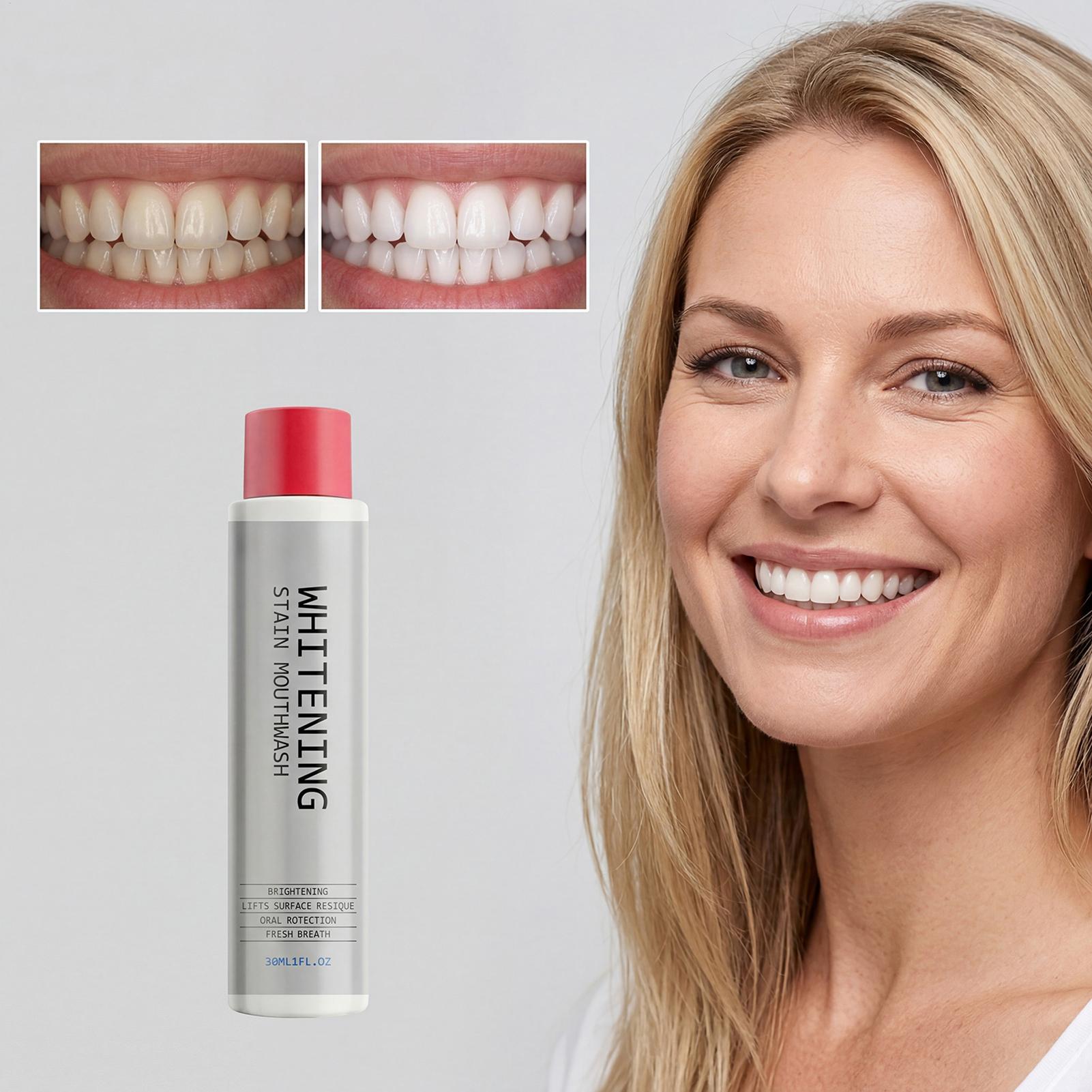 30ml Stain Whitening Mouthwash - Teeth Whitening Mouthwash review and price