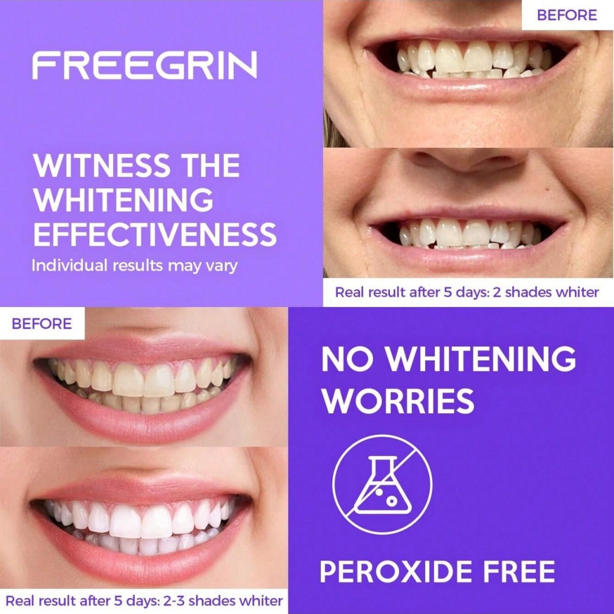 Deluxe Whitening Teeth Sticker - Teeth Whitening Near Me review and price