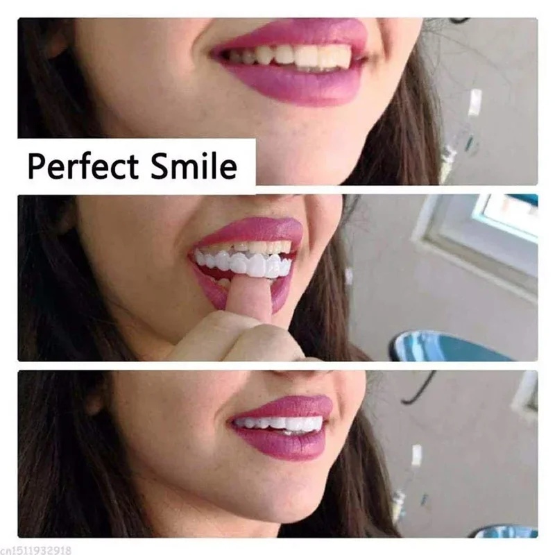 Snap-on Veneer Teeth Kit Adjus - Teeth Whitening Kit review and price